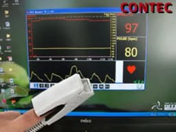 CONTEC Digital PC-Based Pulse Oximeter SPO2 Oxygen Monitor with PC Software And USB CMS-P for Medical Health Monitoring