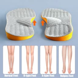 1Pair Flat Feet O/X-Leg Orthopedic Insoles Arch Support Insole for Plantar Fasciitis Shoe Pads Adults Kids Foot Care Shoe Sole