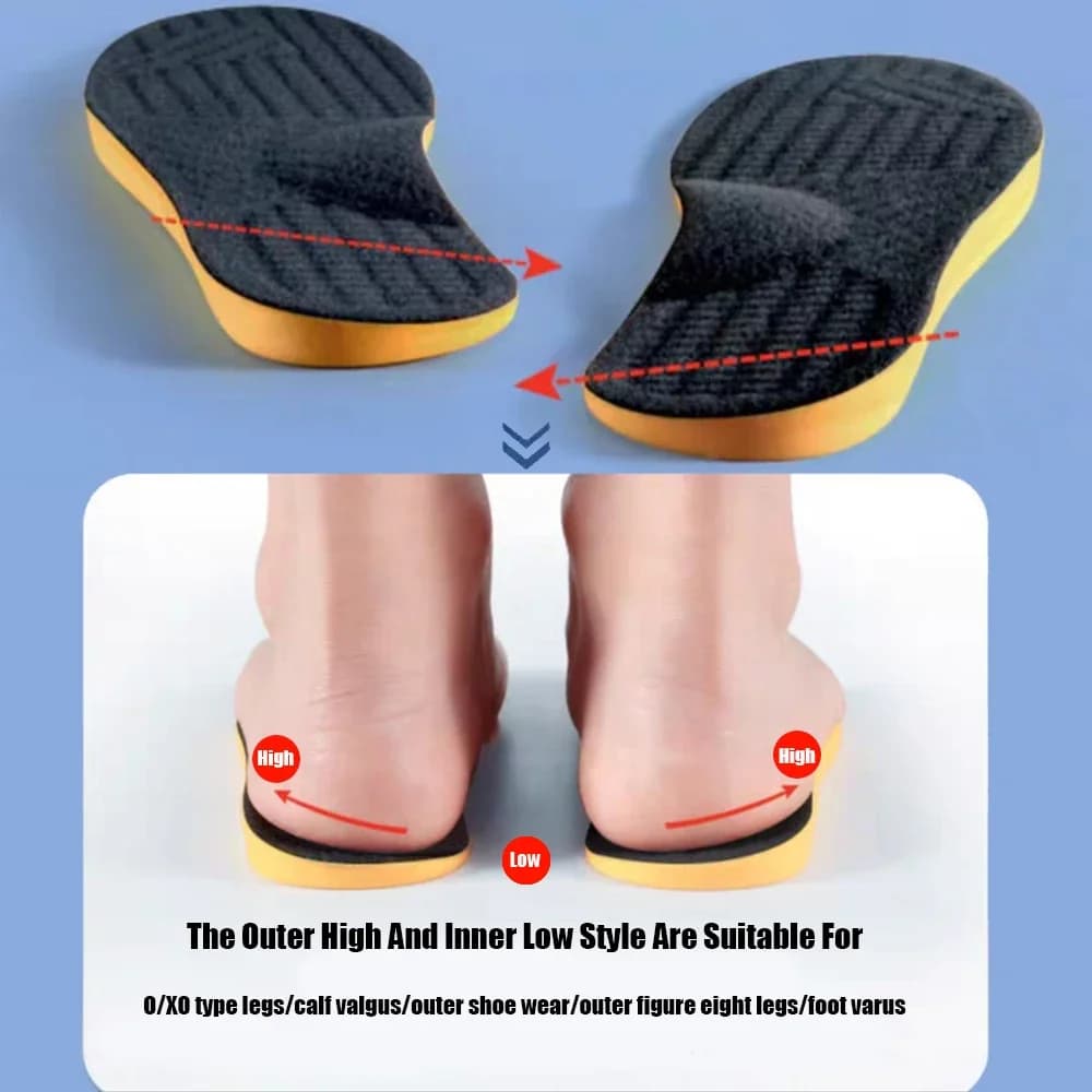 1Pair Flat Feet O/X-Leg Orthopedic Insoles Arch Support Insole for Plantar Fasciitis Shoe Pads Adults Kids Foot Care Shoe Sole