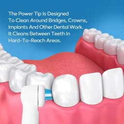 Ortho and Power Tip Brush Heads Compatible with Oralb Electric Toothbrush - Good for Braces, Crowns, Bridges Fit Oral B Pro 1000
