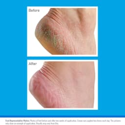 O’Keeffe’s Healthy Feet 91g, For Extremely Dry Cracked Feet, Long-lasting, With glycerin & Allantoin, healthy, hydrated skin