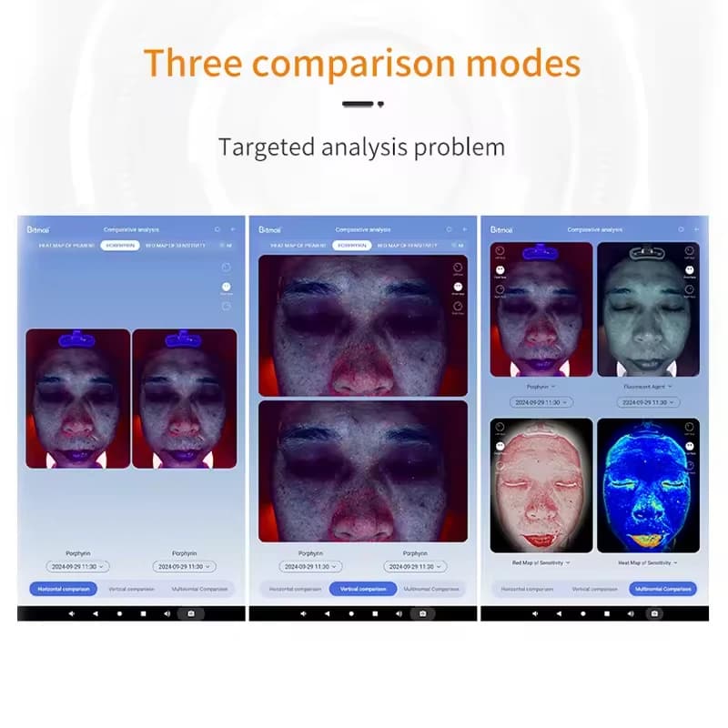 3D digital AI High Configuration 36 Million A6 Intelligent Facial Visia Skin Analyzer machine with Handle Microscopic Detector