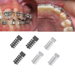2pcs/Bag Dental Orthodontic Rotation Wedges Dentist Bracket Use Dental Ligature Rotary Torsion Pad Tooth Dentistry Tools