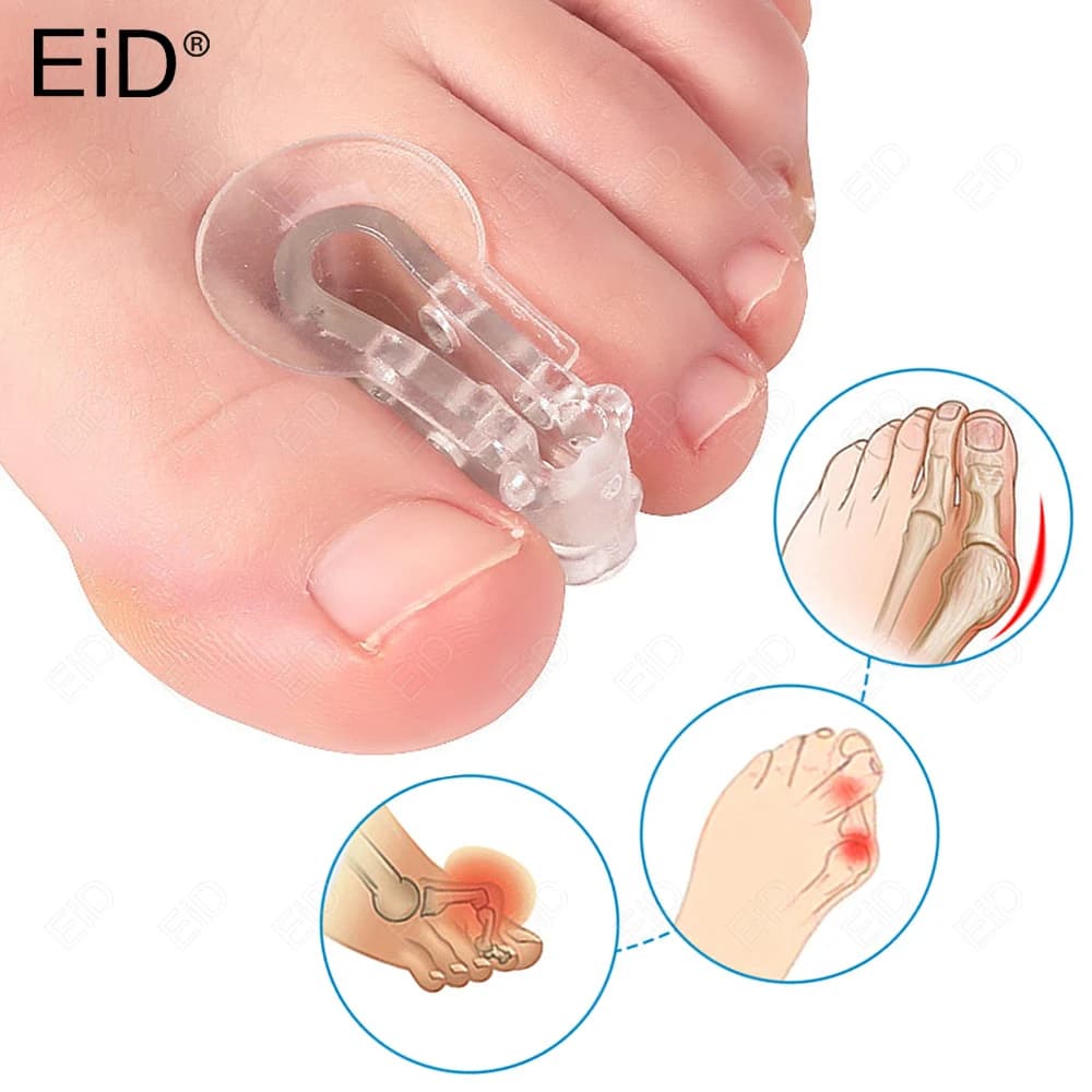 EiD Orthopedic Foot Big Toe Straightener Hallux Valgus Bunion Corrector Orthotics Feet Bone Thumb Adjuster Correction Pedicure