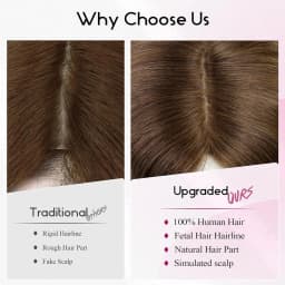 Mixed Blonde Human Hair Toppers 12 inch Human Hair Clip in Bangs Hair Pieces Skin 360° Cover Hair Extension for Women Loss Hair