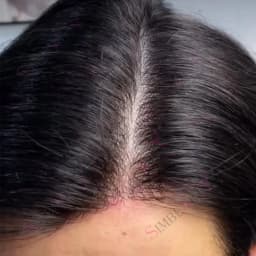 80%Density 0.02mm Invisibility Thin Skin Vloop Prosthetic 1b65 Grey Black Male Toupee Human Hair Men Capillary Prosthesis System