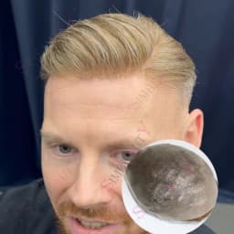 80%Density 0.02mm Invisibility Thin Skin Vloop Prosthetic 1b65 Grey Black Male Toupee Human Hair Men Capillary Prosthesis System