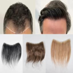 Men's Forehead Hairline Wig High Density Human Hair Skin PU Men's Frontal Hairpiece V Ring Frontal Hair Top