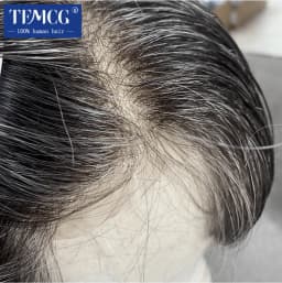 Male Hair Prosthesis 0.03mm Thin Skin Base Men's Capillary Prosthesis Remy Human Hair Men's Wig Replacement System Wigs For Men