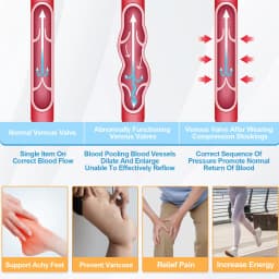 1Pair Ted Hose Thigh High Anti Embolism Compression Stockings for Women Men, Surgical Compression Stockings, 15-21 MmHg