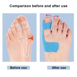 10PCS Bunion Corrector & Pain Relief Kinesiology Athletic Tape For Bunions & Turf Toe,Big Toe Spacer/Separator/Straightener Tape