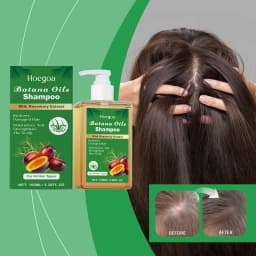 100/300ml Batana Oil & Rosemary Hair Care Shampoo Deep Nourishing Scalp Remove Dandruff Strengthens Hair for Shiny Shampoo Hair