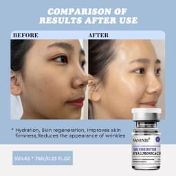 Sanendi Hyaluronic Acid PDRN GLUTATHIONE Retionl Serum for Face Dr.Pen DEEP HYDRATION Firmness Anti-aging 7ML*5Vials