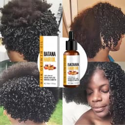 Batana Oil Hair Growth Products Fast Growth Batana Essence Oil Traction Alopecia Anti Hair Loss Baldness Treatment For Men Women