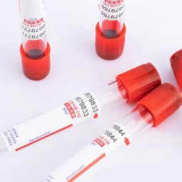 100 Tubes Platelet Rich Fibrin Tube with No Additive 10ml Vacutainer Blood Collection Tubes for Veterinary Lab Supplies