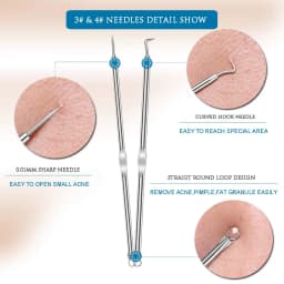 4PCS Stainless Steel Blackhead Remover Extraction Pimple Comedone Acne Extractor Whitehead Blemish Popper Kit