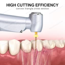 Glin Dental Gold Flexible Files Endo Rotary Files Golden Endodontic Files 21/25/31mm Nickel Titanium Instrument Dentistry