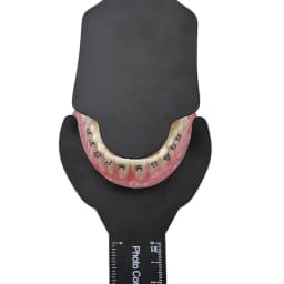 Dental Photo Background Board  Oral Orthodontic Photography Contraster Oral Cheek Plate Black Background Image Contrast Board