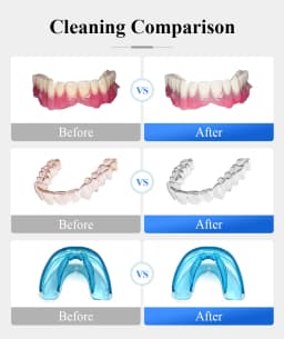 Tullker Household Ultrasonic Retainer Cleaner for Denture Jewelry Braces Cleaning with UV Light