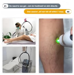 2026 SLyriclaser 1064/532nm long pulse width High quality 1064nm painless hair removal Clinic 755NM alexandrite machine