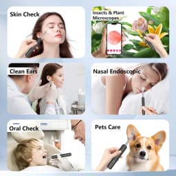 Smart Visual Ear Cleaner HD Ear Sticks Otoscope USB C Charging Endoscope Wax Removal Tool Earpick MIni Camera Health Care Set