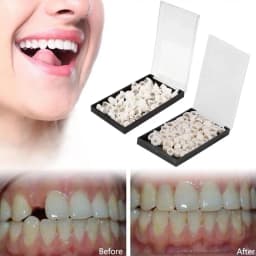 Dental Temporary Crown Black Box Rectangle Box Dental Crowns Anterior Posterior Teeth Porcelain Veneers Teeth Crowns