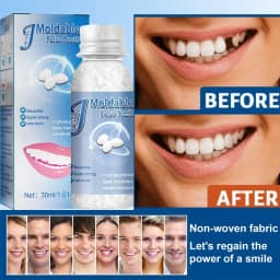 Temporary Tooth Repair Beads Missing Broken Teeth Dental Tooth Filling Material Food Grade False Teeth Solid Glue Denture