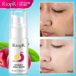 Vitamin C Snail Essence Anti-aging Anti-wrinkle Shrink Pores Whitening Moisturizing Essence Oil Control Face Essence Skin Care