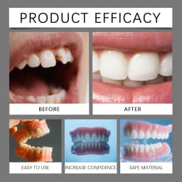 Orthodontic False Teeth Silicone Kit Soft Comfortable Fake Tooth Upper Lower Veneers Denture Set for Oral Hygiene Care