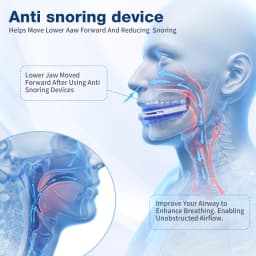 Adjustable Anti Snoring Mouthpiece for Adults, Boil and Bite Custom Fit Sleep Aid, 1mm-6mm Jaw Advancement Oral Device, Open Airflow Design, Reusable Night Guard with Portable Storage Case for Home Travel