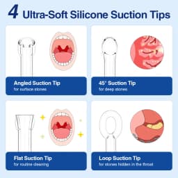 Electric Vacuum Tonsil Stone Removal Tool Kit 3-Level Suction Tonsil Cleaner Tonsil Stone Extractor for Oral Fresh Care