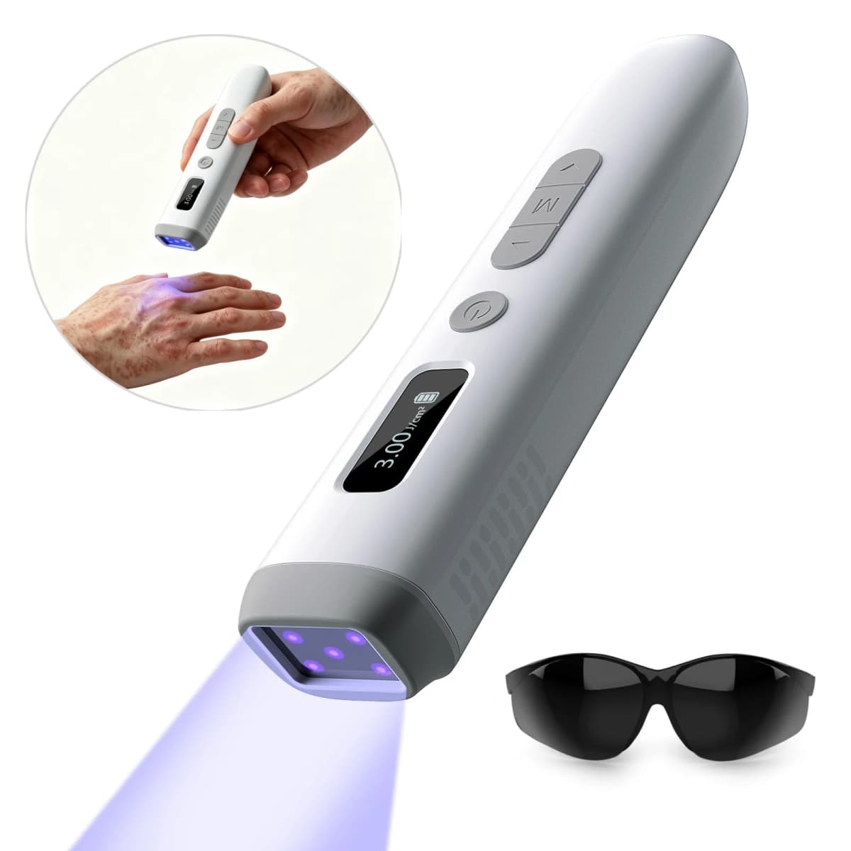 UVB 308nm Phototherapy Wand Handheld Home Care Device, Pure Narrowband Light Source for Skin Care, 150g Lightweight Rechargeable with Digital Dose Display, Precise 15x15mm Target, Adjustable Dose & Protective Glasses Included