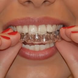 1/4/8pcs Anti Snoring Bruxism Sleeping Mouth Guard Tray Stop Teeth Grinding Sleep Aid Night Guard Gum Shield Mouth Health Care