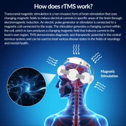 TMS Stimulate Nerve Cells Transcranial Magnetic Stimulator Machine Treatment Parkinson Insomnia Anxiety Depression Insomnia RTMS