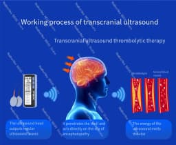 Portable tDCS Brain Stimulator Electric Head Massager, Headache Pain Relief Therapy Machine