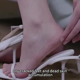 Electric Foot Grinder, USB Charging Foot Polishing Machine, Foot Skin Grinder, Heel Calluses and Dead Skin Removal Tool