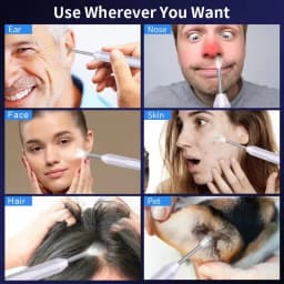 HD Ear Cleaner Otoscope with Camera Earwax Remover Tool Kit with 6 LED Lights for iPhone iPad Android Smart Phone