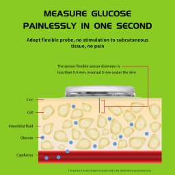 Freestyle Libre CGM Sensor Kit 14 Days 24h Dynamic Blood Glucose Meter Monitor Blood Sugar Changes Anytime Anywhere Android App