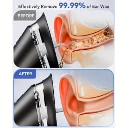 Electric Ear Irrigation Cleaner with Three Pressure Modes Rechargeable Battery Dual Water Tank and Multiple Nozzles for Home Use