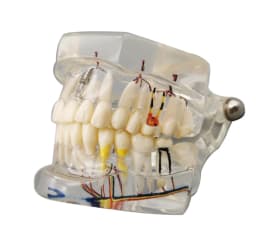 AG Teeth Neural Repair Dental Implant Pathological Model Dentist Students Communication Learning Research Oral Disease Teaching
