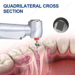 Glin Dental Root Canal Rotary Files 3Pcs/Box Safety Tip Niti Endo Files 21/25mm Dentistry Instrument W-One Endodontics Files