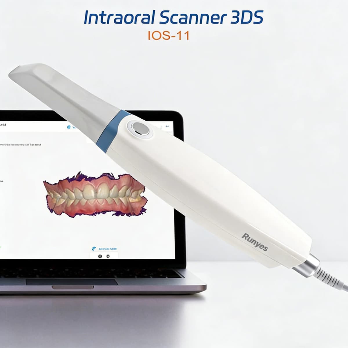 Dental Intraoral 3D Scanner Runyes V3 3.0 Pro, CMD CAD Orthodontic Restoration