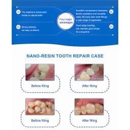 A1 A2 A3 A3.5 B1 Universal Dental Light Curing flowable Composite Resin for Tooth Restoration Dental Materials Available In 4 Co