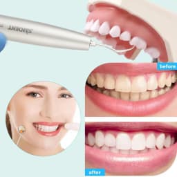 Dental Fiber Optic Air Scaler SONICflex Sonic L Fit KaVo Multiflex Led Coupling / GK LED Coupler
