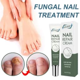 25g Nail Care Cream Anti-fungals Nail Therapy Serum Foot Nail Fungi Removal Gel Anti Infected Paronychia Onychomycosis Product