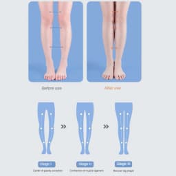 PU Orthotic Insole Arch Support Flat Foot Orthopedic Insoles for Shoes Women Men X/O Type Legs Valgus Feet Correction Shoe Pads