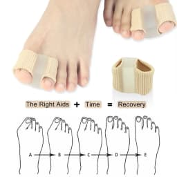 2PCS Bunion Corrector Toe Splint Straightener Hallux Valgus Foot Separator