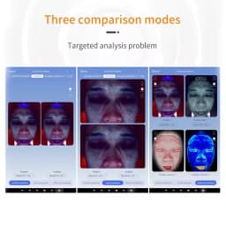 3D digital AI High Configuration 36 Million A6 Intelligent Facial Visia Skin Analyzer machine with Handle Microscopic Detector
