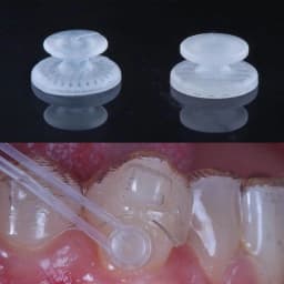 50pcs Orthodontic Dental Direct Bond Eyelet Lingual Buttons Tongue Tamers Bite Opener Cleat Small Sliding Crimpable Hook Tools