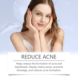 20/40/60g Anti Acne Cream Oil Control Repair Pimple Spot Remove Acne Mark Cleaning Refreshing Moisturizer Skin Pore Shrink Cream